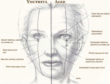 face lift and neck lift FACE LIFT AND NECK LIFT youthful vs aged