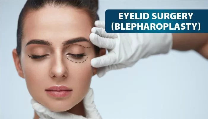 Blepharoplasty