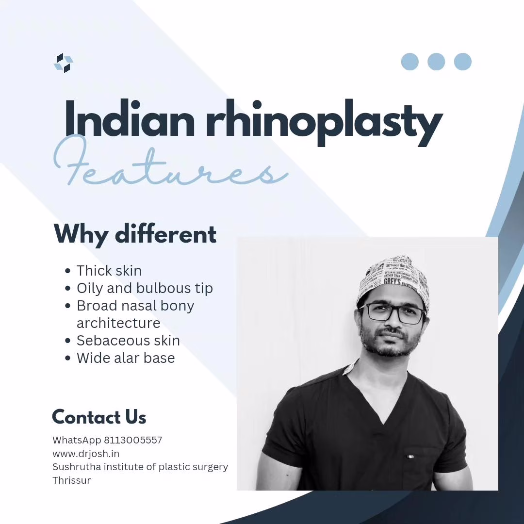 Male Rhinoplasty in Kerala