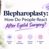 Blepharoplasty: